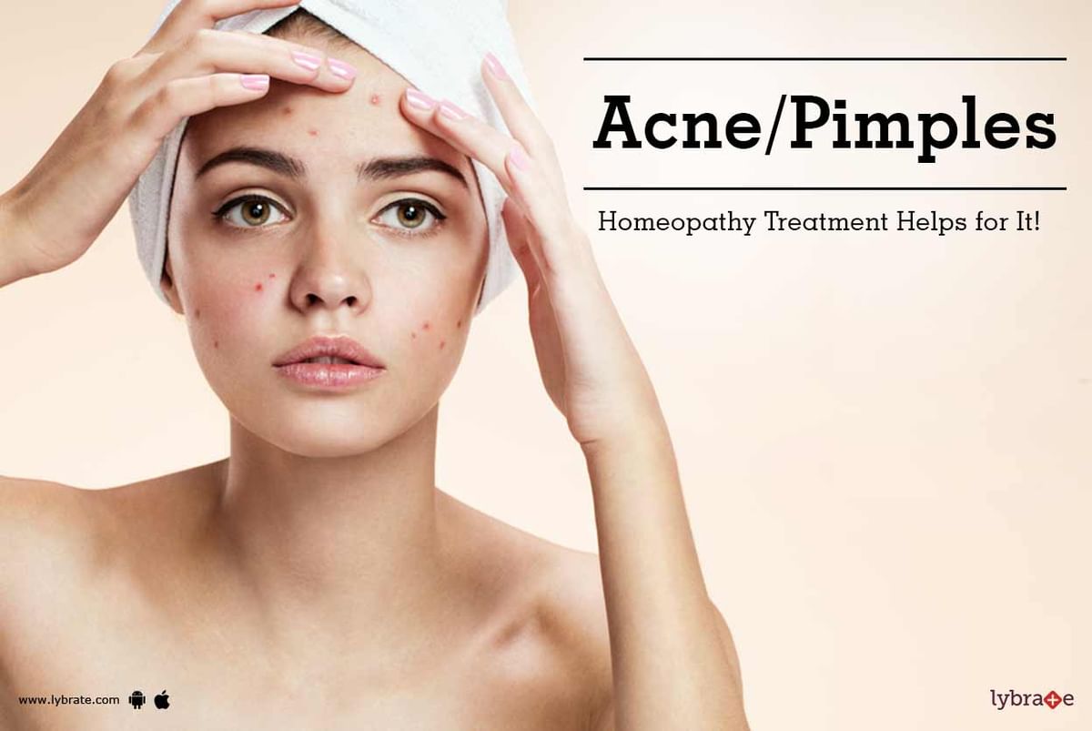 Acne/Pimples - Homeopathy Treatment Helps for It! - By Dr. Sandeep ...