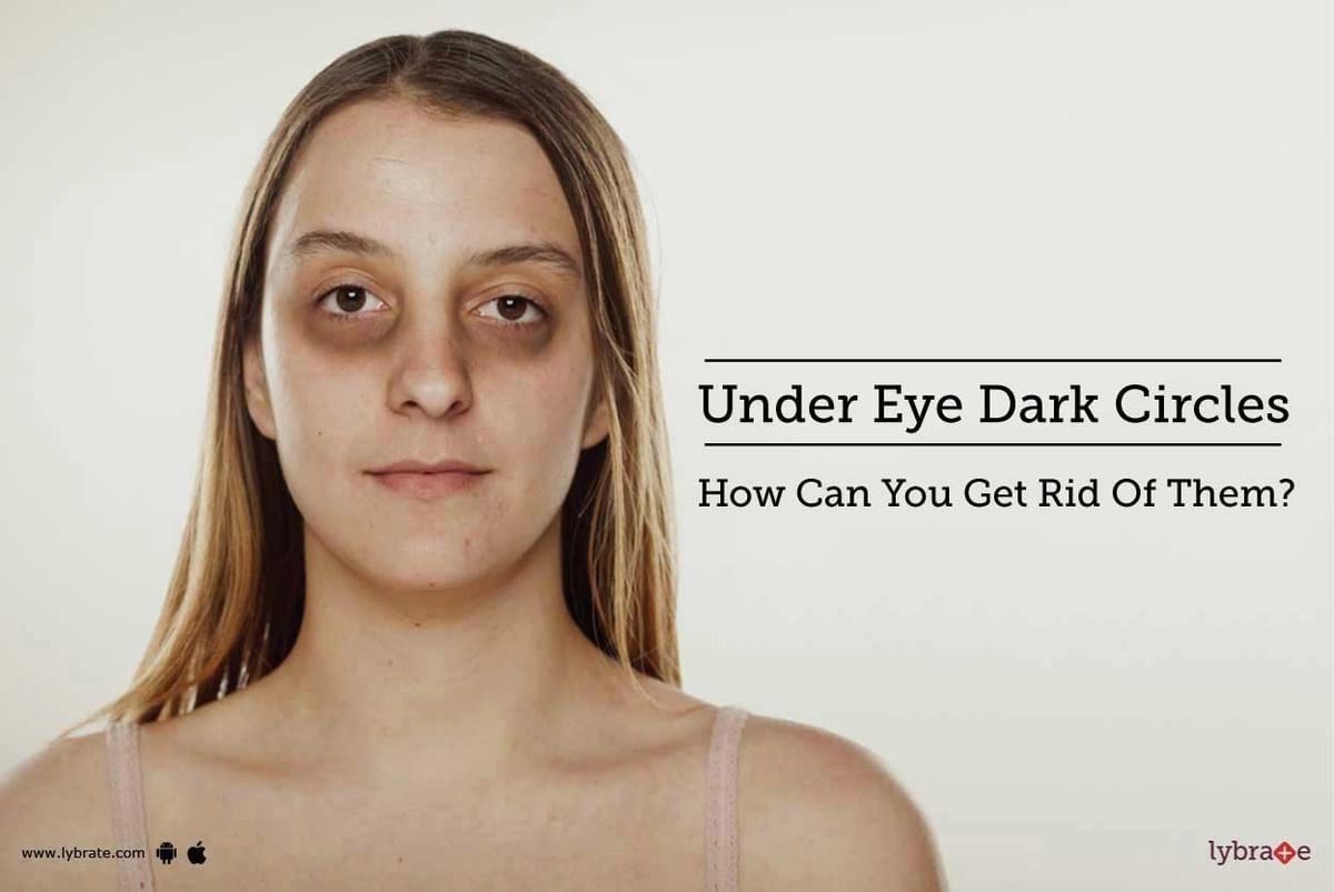 Under Eye Dark Circles - How Can You Get Rid Of Them? - By Dr. Jyoti S ...