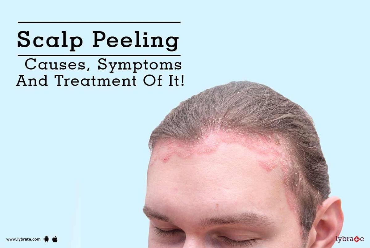 Scalp Peeling - Causes, Symptoms And Treatment Of It! - By Looks Forever  Hair And Skin Aesthetic Clinic | Lybrate