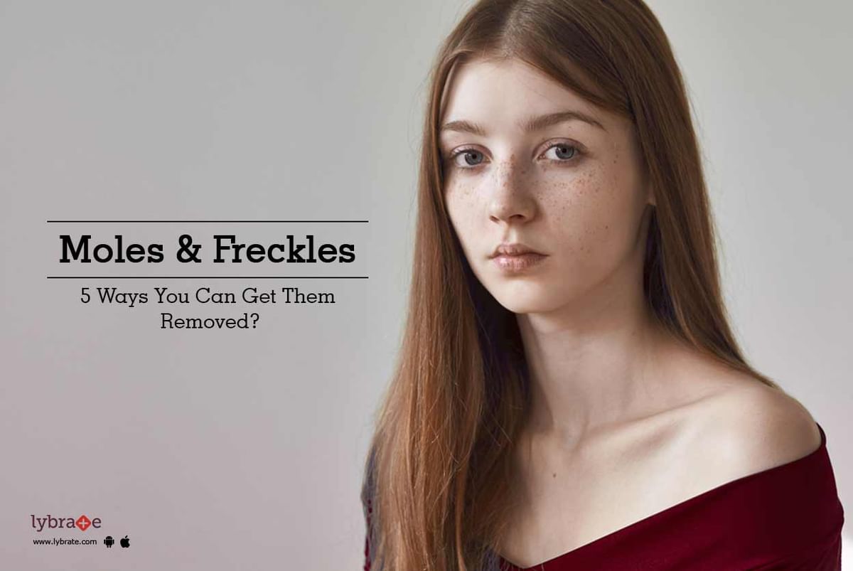 Moles & Freckles - 5 Ways You Can Get Them Removed? - By Dr. Anubhav ...