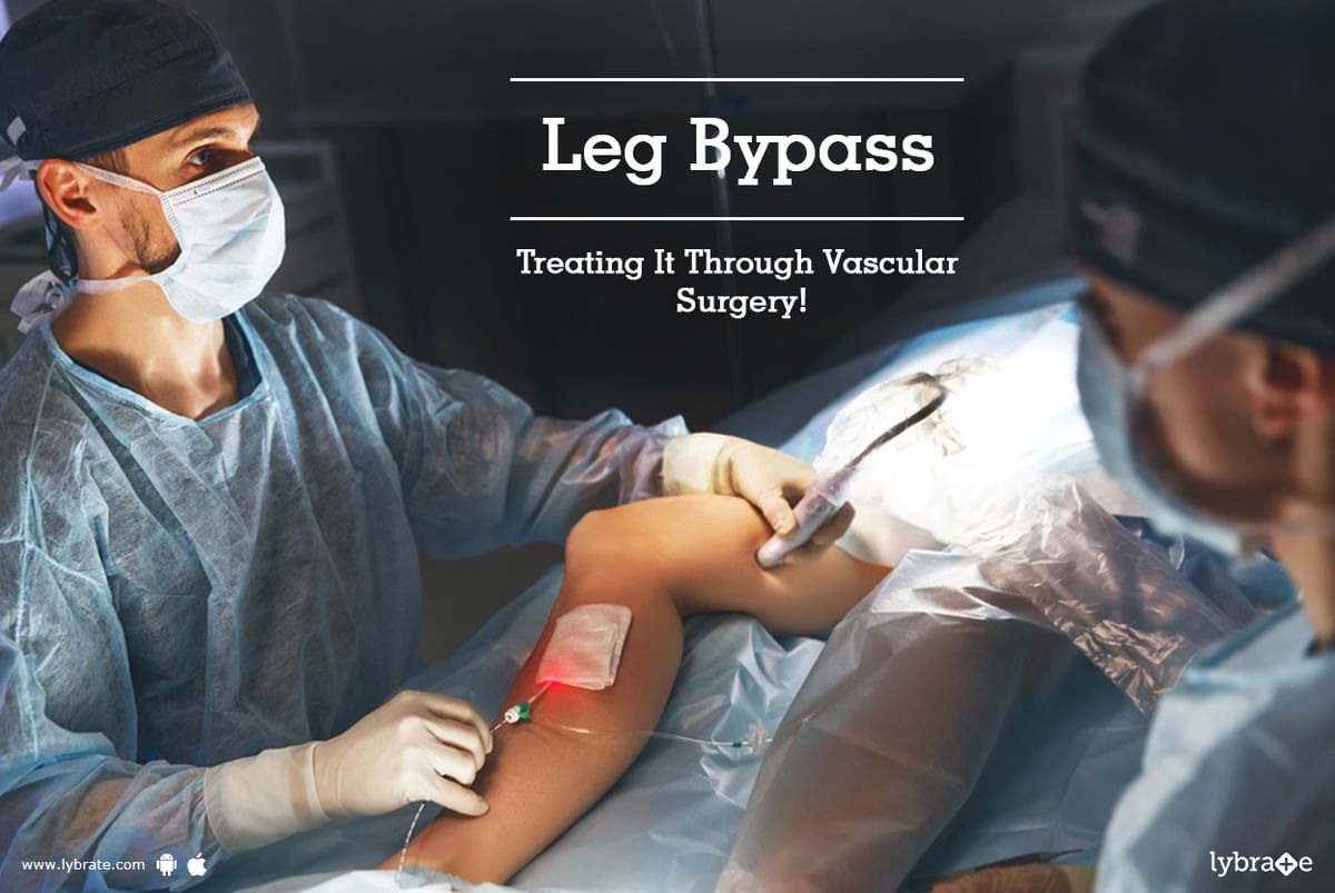 leg-bypass-treating-it-through-vascular-surgery-by-dr-ramakrishna