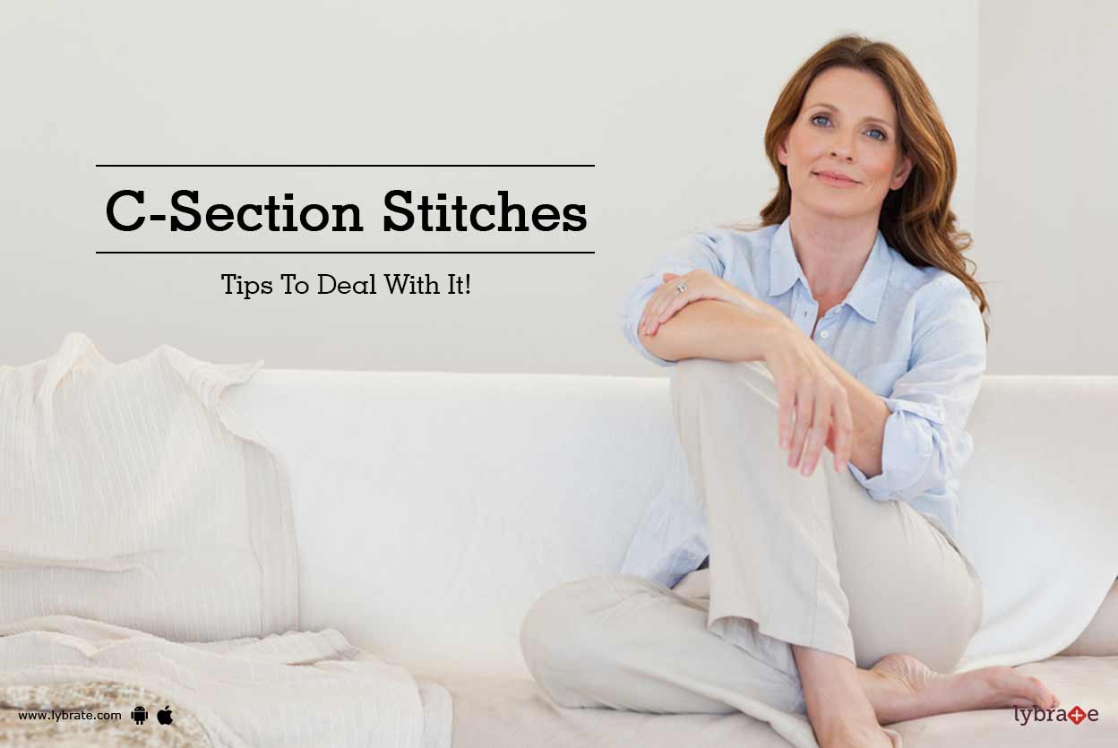 CSection Stitches Tips To Deal With It! By Dr. Ruchi Rai Ahuja