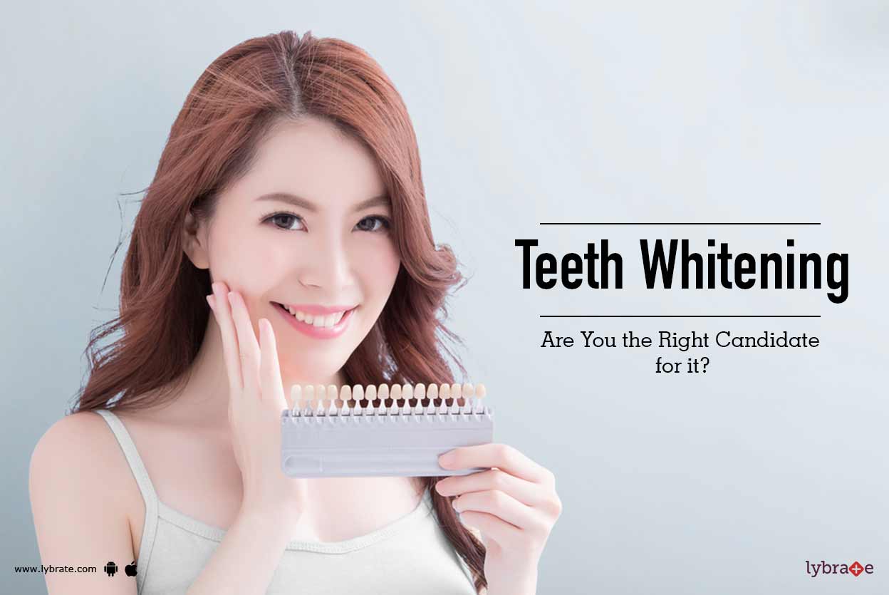 Teeth Whitening Are You the Right Candidate for it? By Dr. Diksha