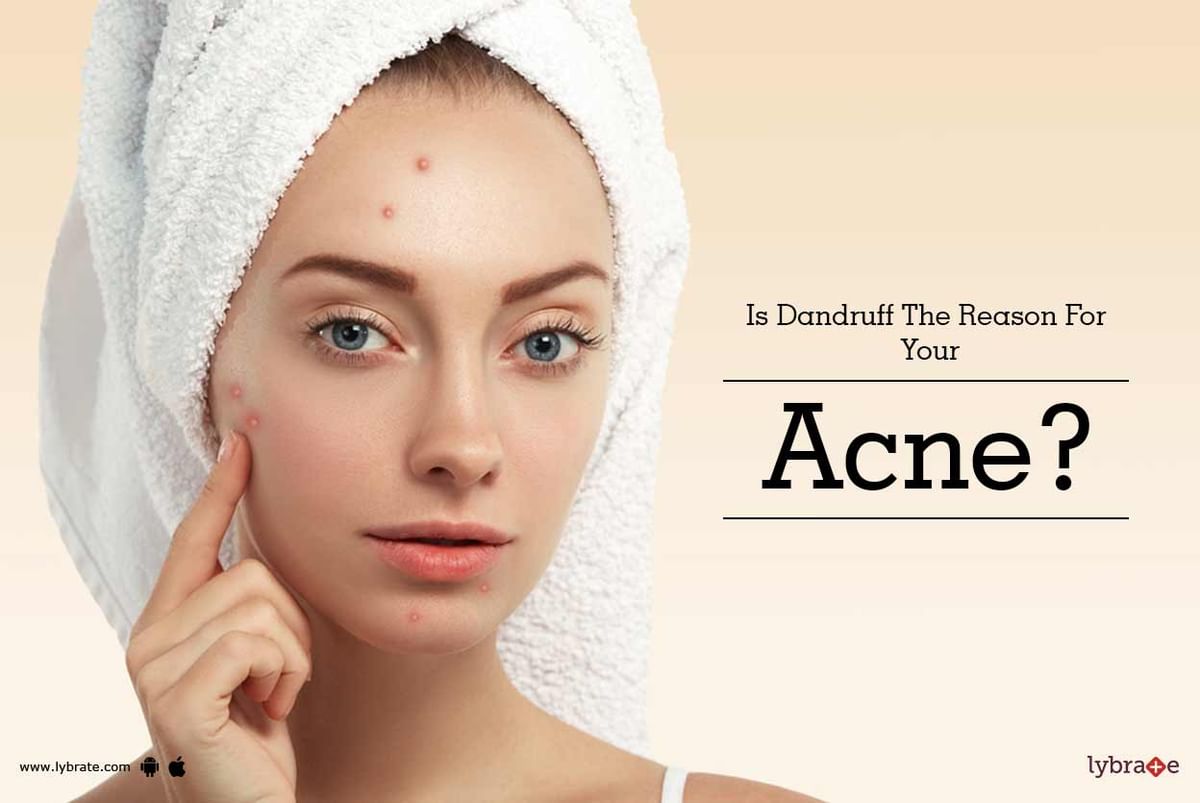 is-dandruff-the-reason-for-your-acne-by-dr-jyotisterna-mittal-lybrate