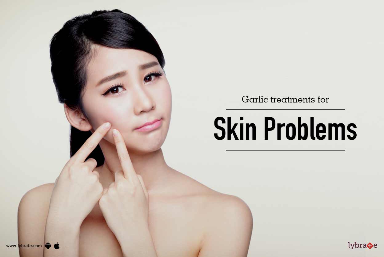 Garlic Treatments For Skin Problems By Dr. Deepshikha Parihar Lybrate