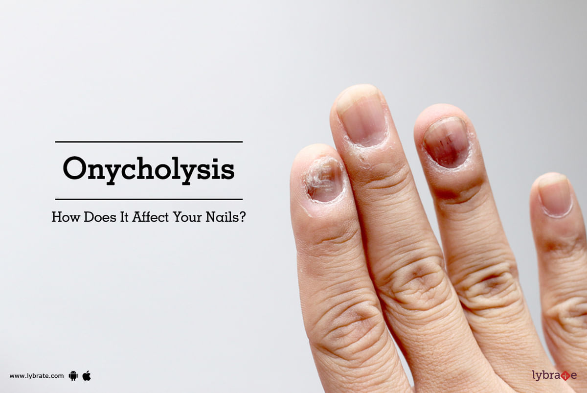 Why Are My Nails Separating? Everything You Need to Know About Onychol –  Dr. Dana
