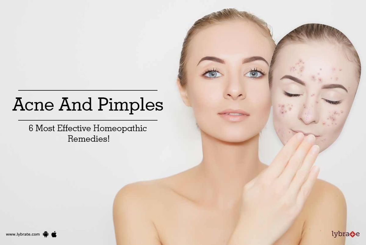 Acne And Pimples: 6 Most Effective Homeopathic Remedies! - By Dr ...