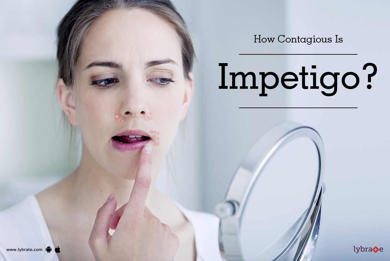 How Contagious Is Impetigo? - By Isaac - International Skin & Anti ...