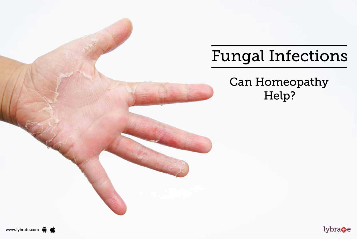 Fungal Infections Can Homeopathy Help? By Dr. Mrs Neeraj Gupta
