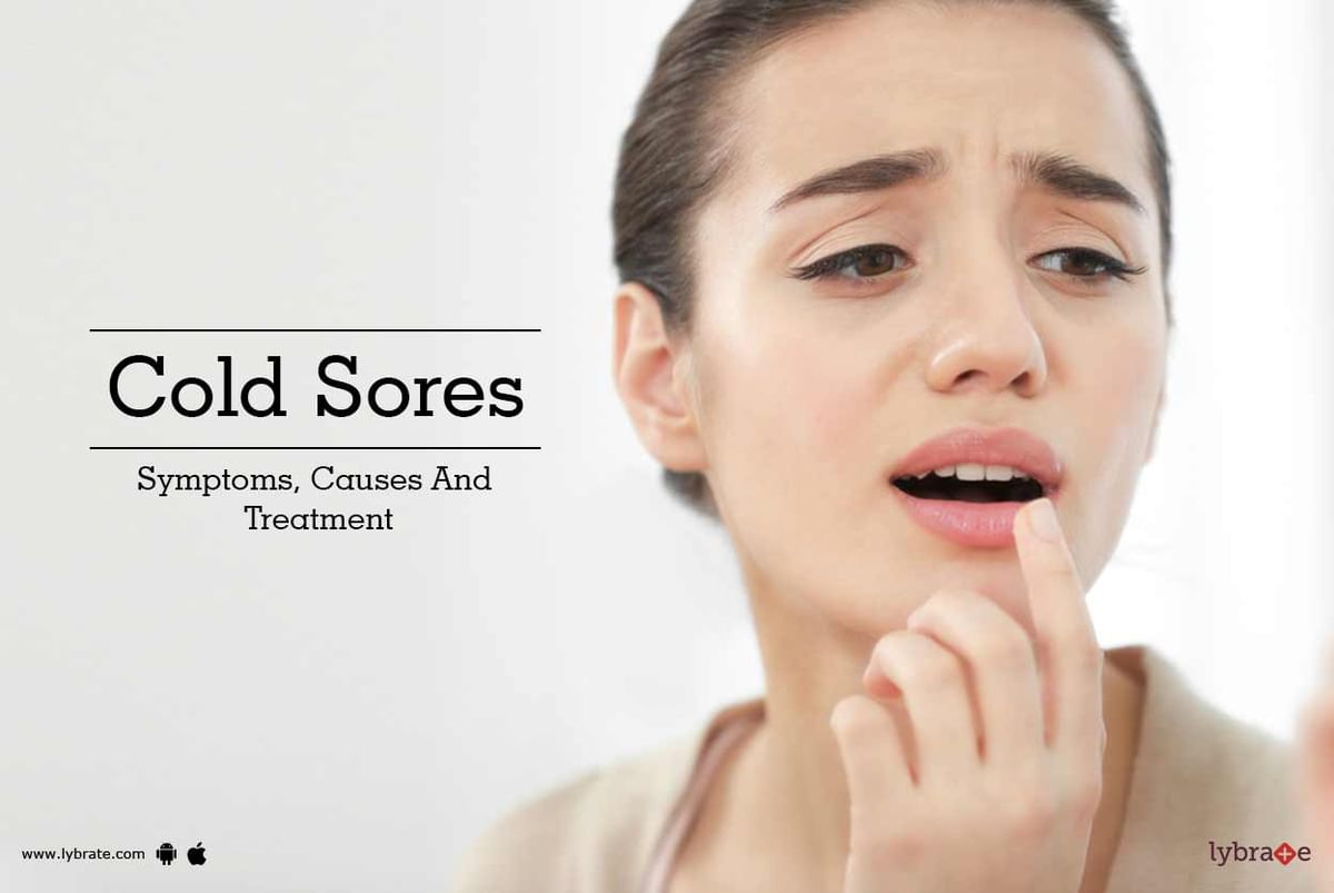 Cold Sores - Symptoms, Causes And Treatment - By Dr. Renu Madan | Lybrate