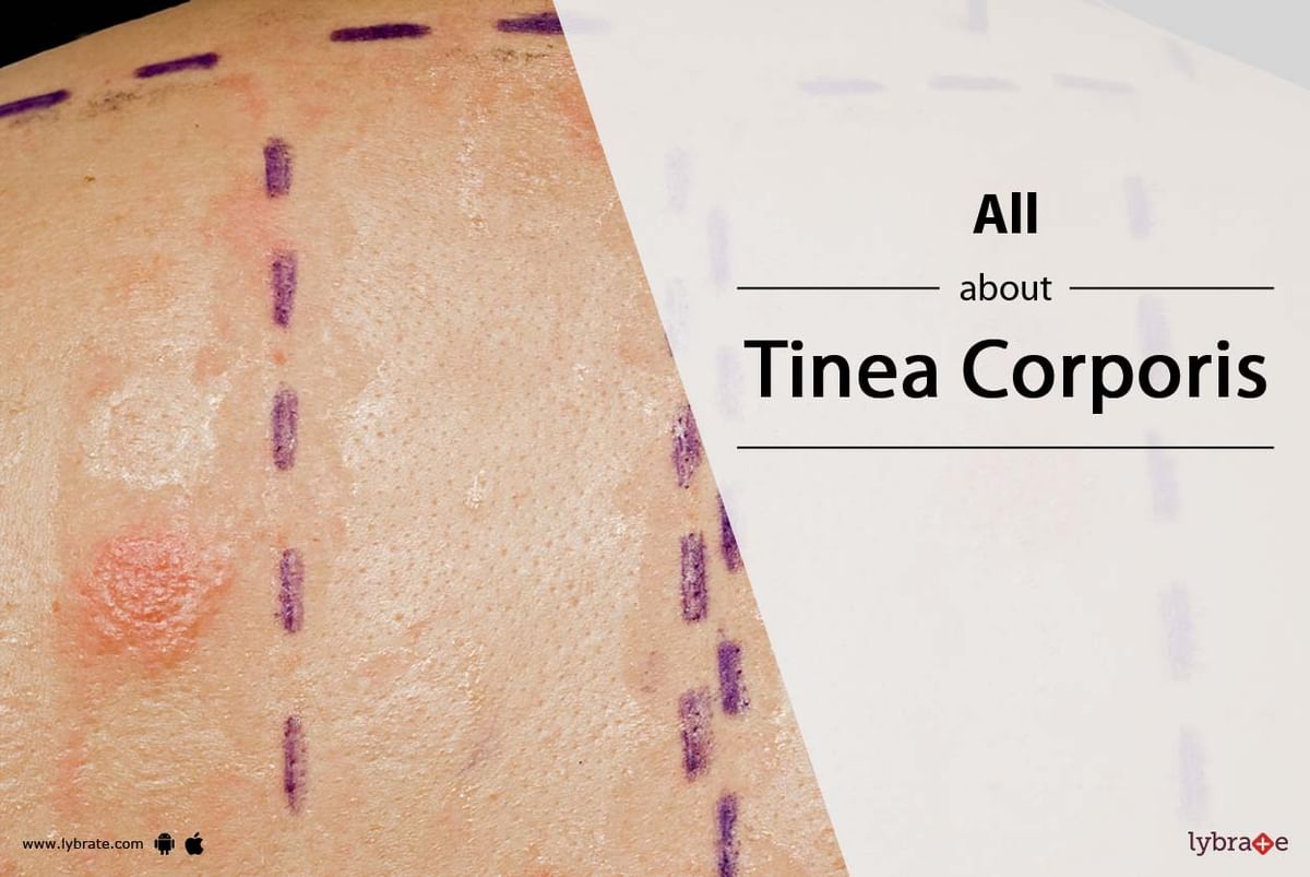 The Secrets of Tinea Corporis and Glowing Skin