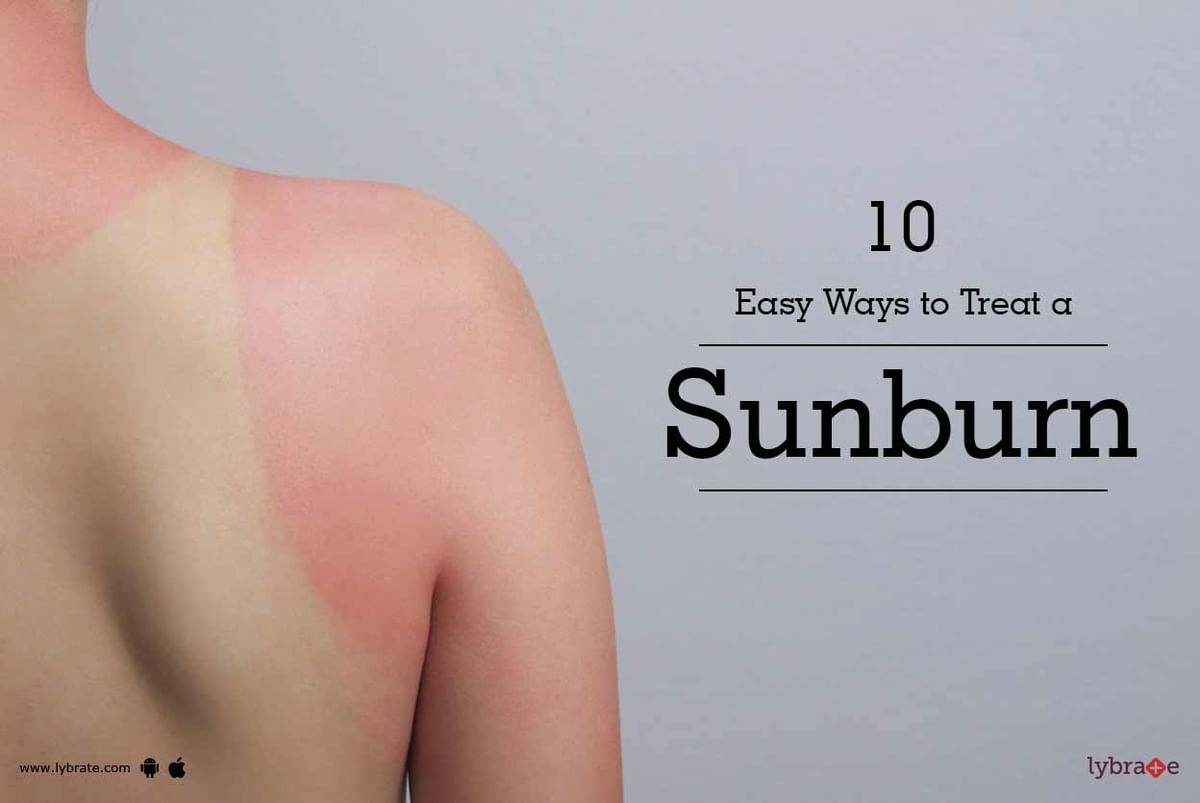 10 Easy Ways to Treat a Sunburn - By Dr. Shaunak Patel