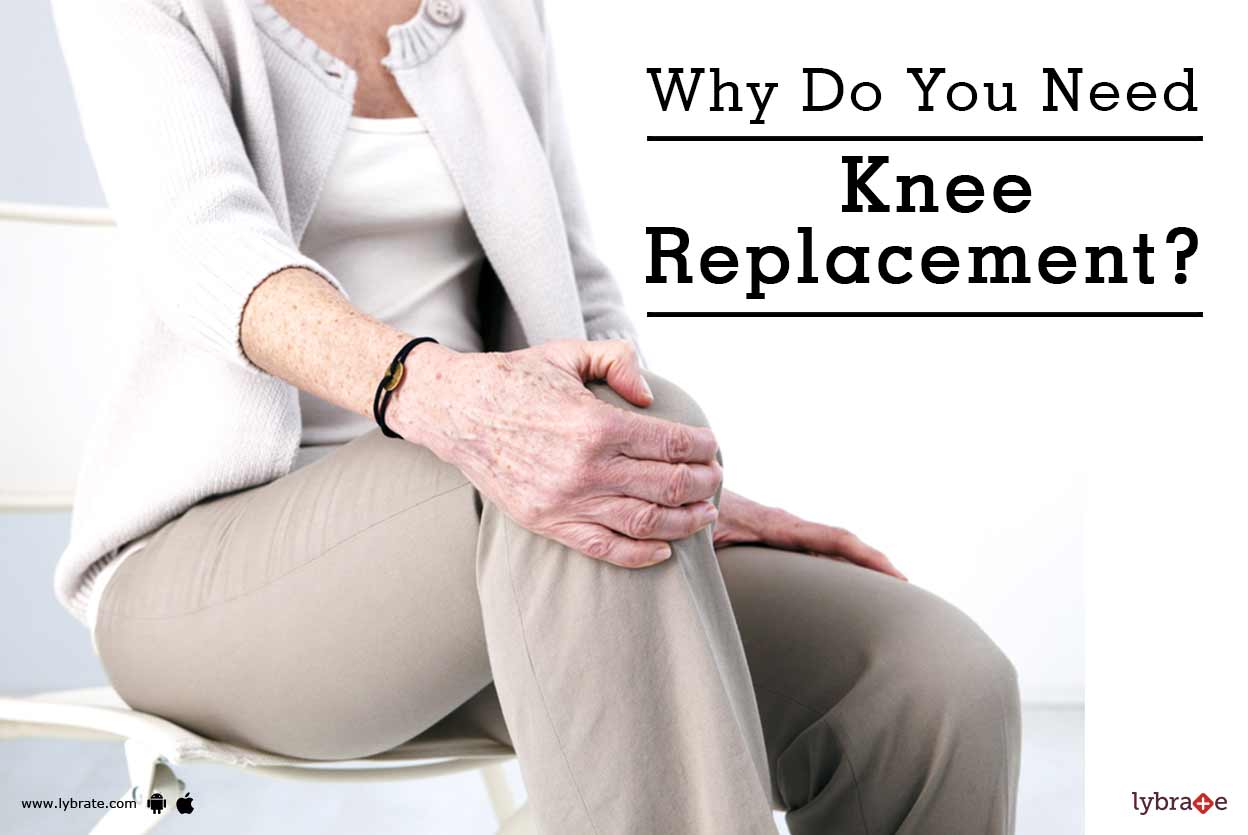 Why Do You Need Knee Replacement? By Dr. Shivendra Srivastava Lybrate