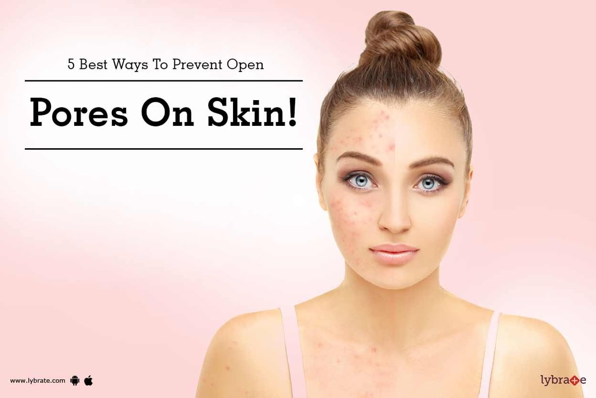 5 Best Ways To Prevent Open Pores On Skin! - By Dr. Anuj Saigal | Lybrate