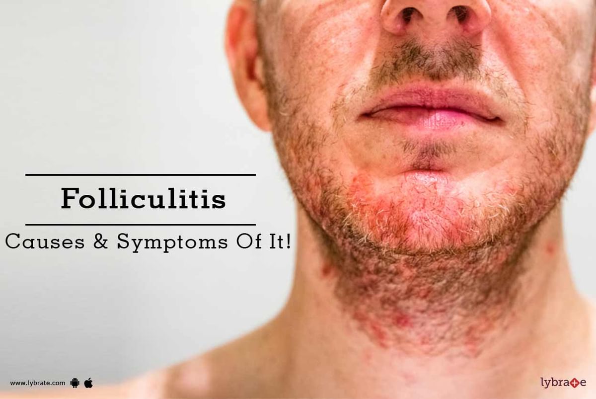 Folliculitis - Causes & Symptoms Of It! - By Dr. Abhigyan Mukherjee |  Lybrate