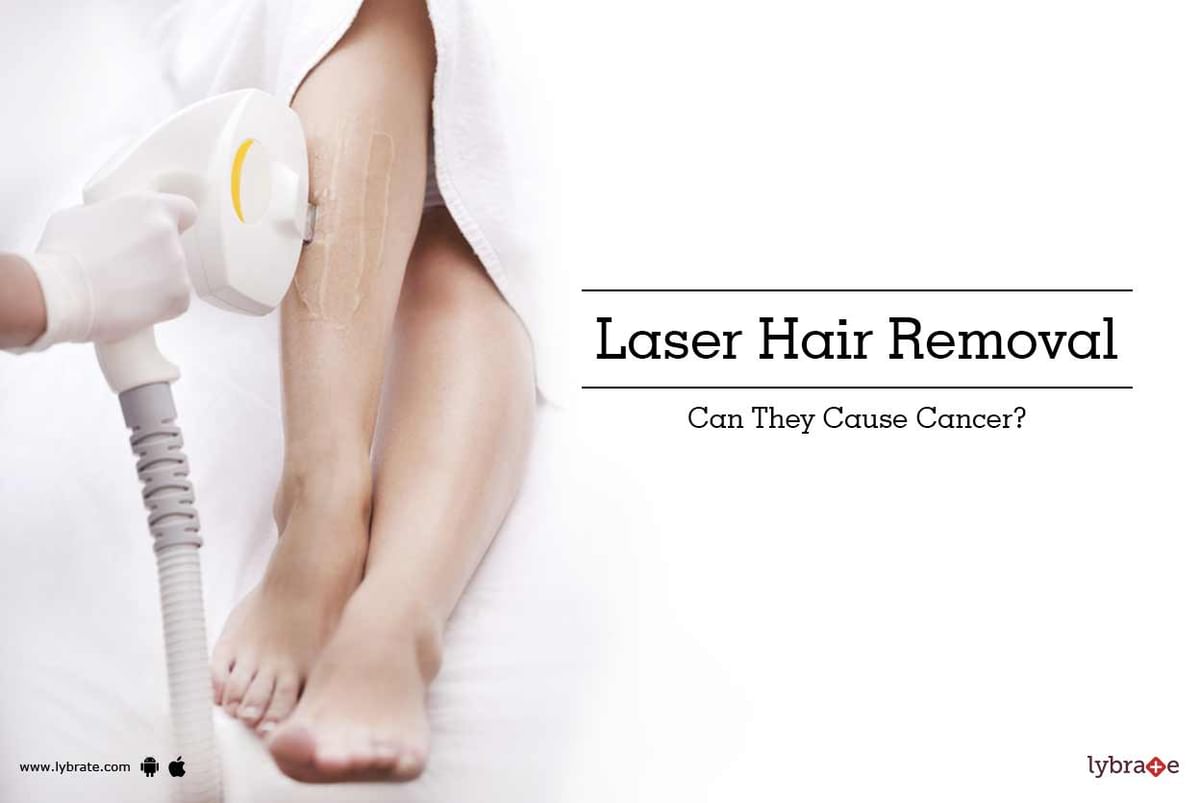 Laser Hair Removal - Can They Cause Cancer? - By Dr. Sumit Gupta | Lybrate