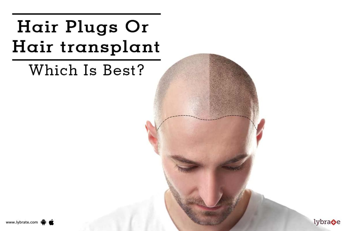 Hair Plugs Or Hair transplant - Which Is Best? - By Adon Trichology Clinic  | Lybrate