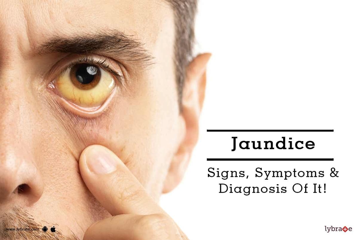Jaundice - Signs, Symptoms & Diagnosis Of It! - By Dr. Sunaina Rohatgi |  Lybrate