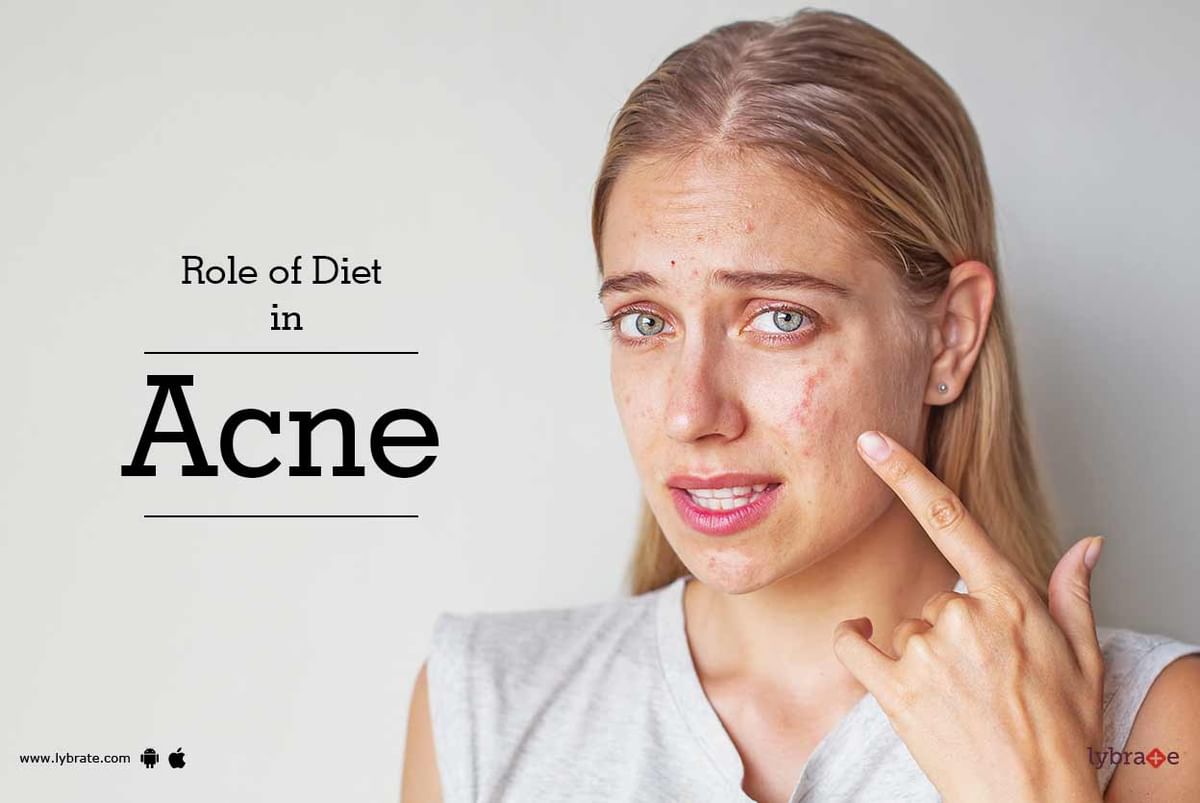 Role Of Diet In Acne - By Dr. Himanshu Singhal | Lybrate