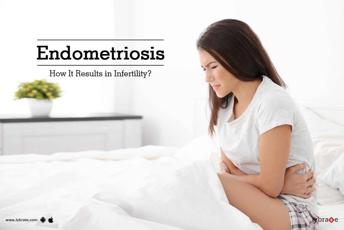 Endometriosis - How It Results in Infertility? - By Dr. Shweta Goswami ...