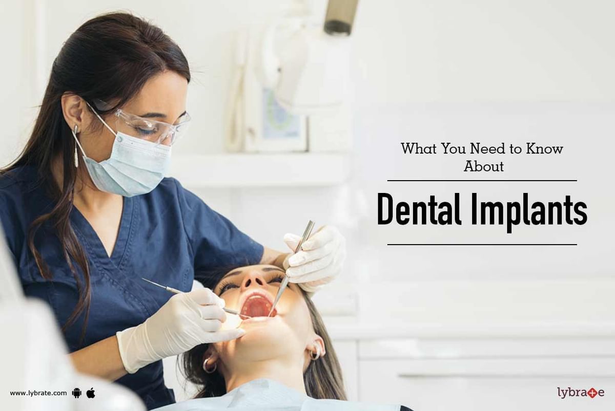 What You Need to Know About Dental Implants - By Dr. Ayush Sharma | Lybrate