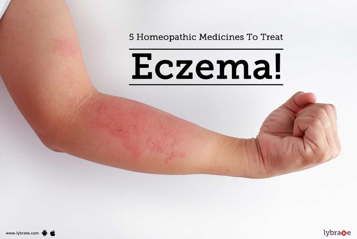 5 Homeopathic Medicines To Treat Eczema! - By Dr. Anand Dhoot | Lybrate