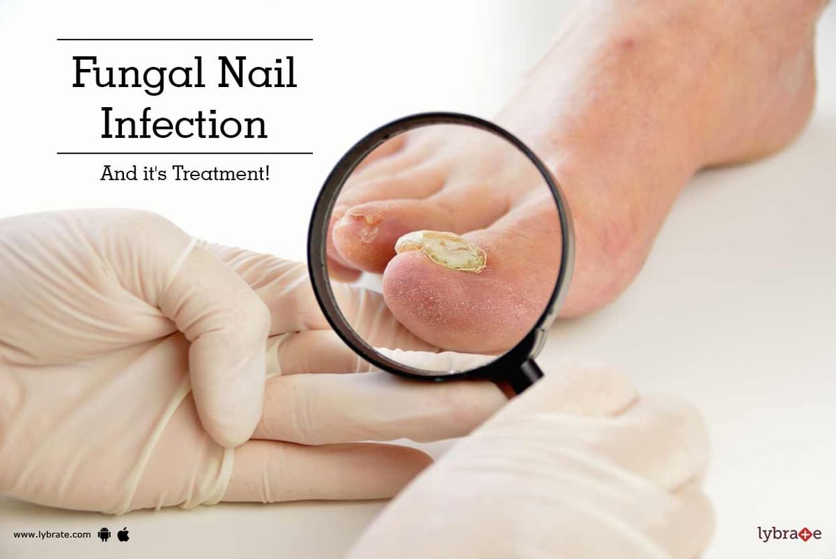 Nail Fungus Antifungal Home Treatment Toe and Finger Nail Infection Natural  Cure | eBay