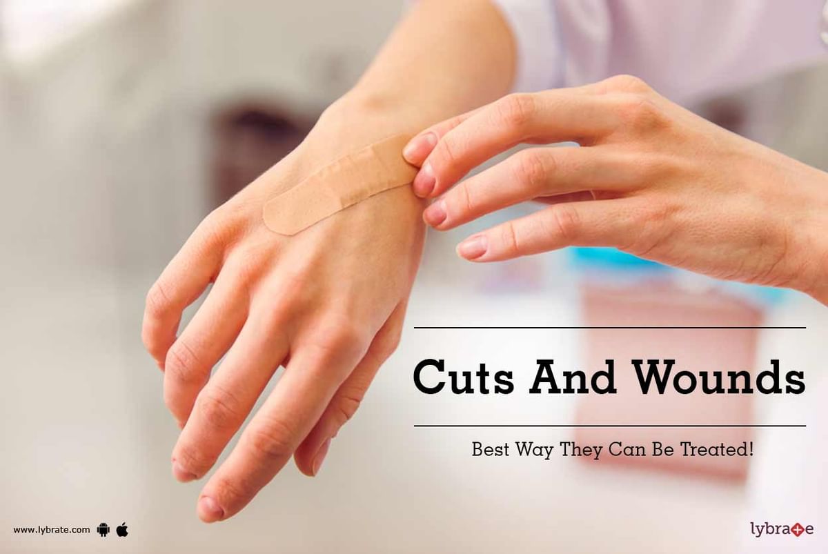 Cuts And Wounds - Best Way They Can Be Treated! - By Dr. Arunesh Dutt ...