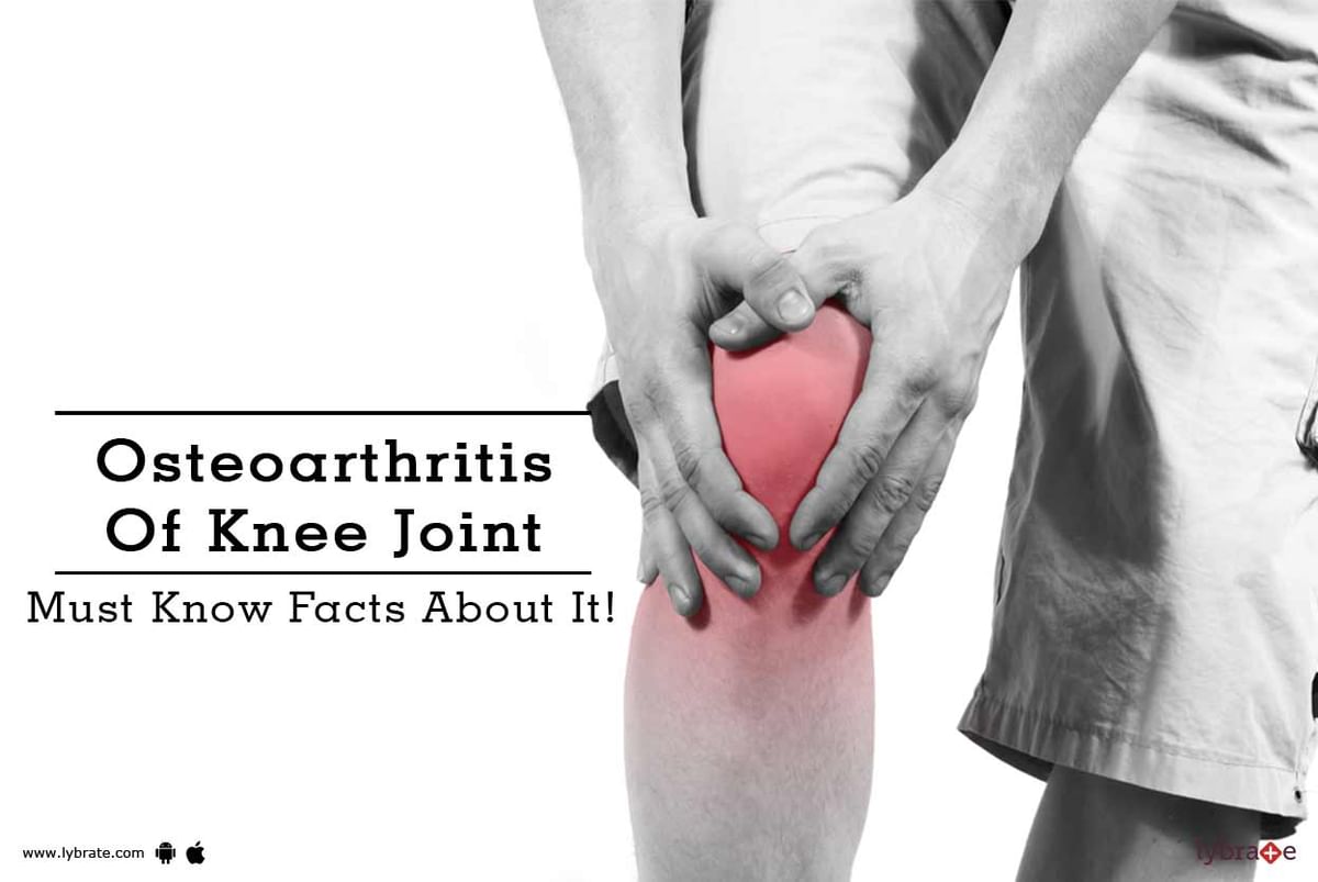 Osteoarthritis Of Knee Joint - Must Know Facts About It! - By Dr. Ashu ...