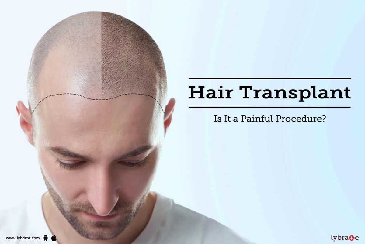 Hair Transplant - Is It a Painful Procedure? - By Dr. Rohit Shah | Lybrate