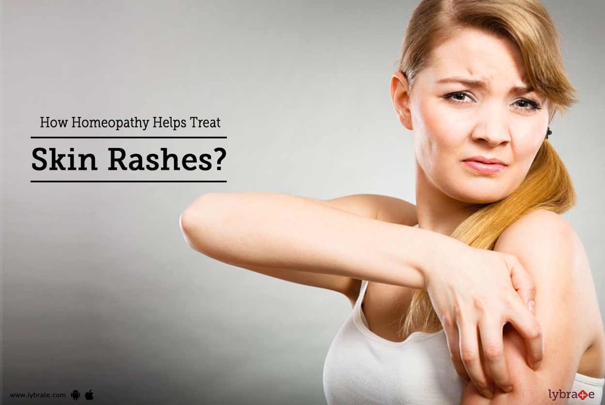 How Homeopathy Helps Treat Skin Rashes By Dr Soumalya Golder Lybrate