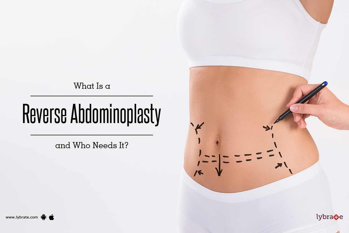 What is a reverse abdominoplasty and who needs it?