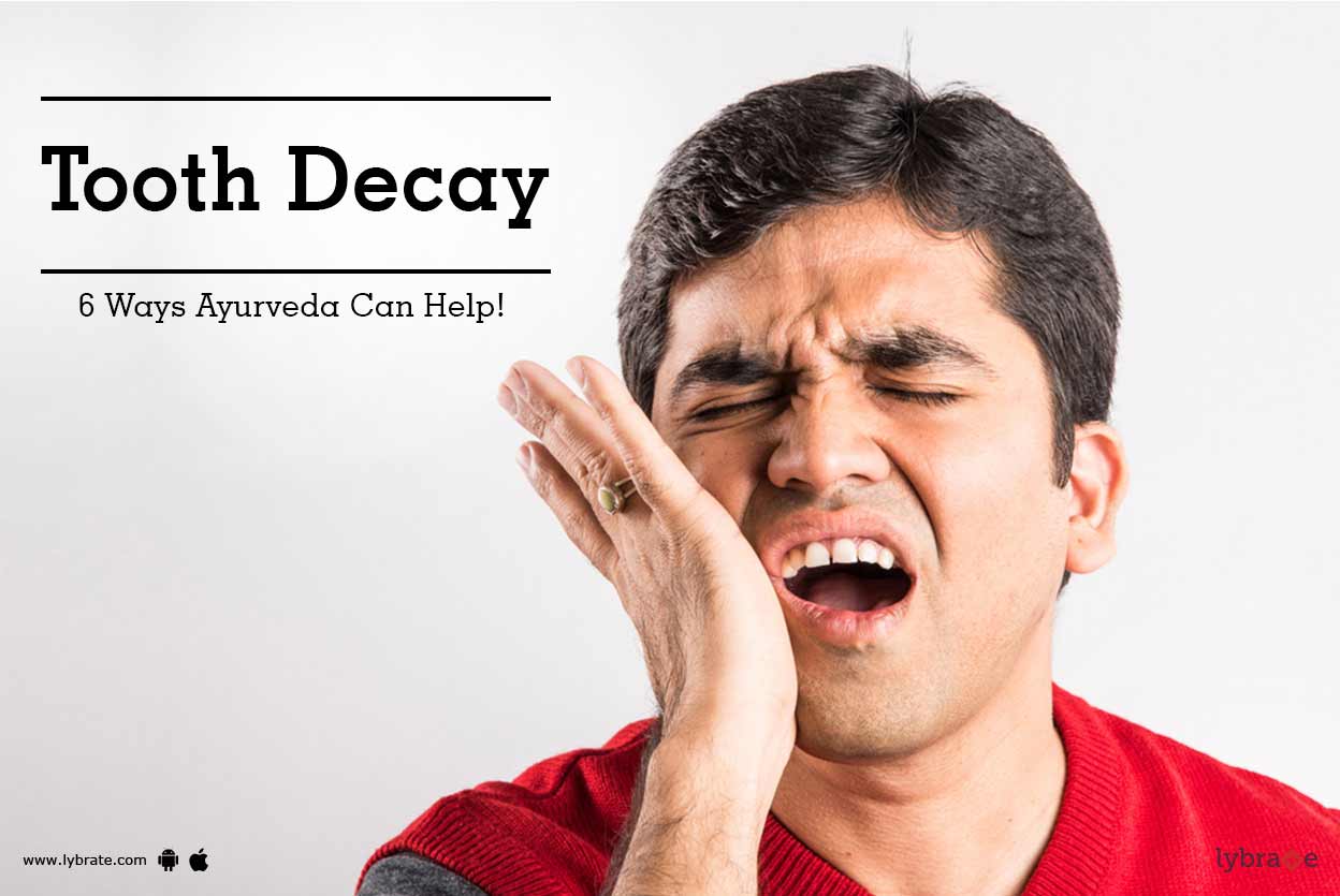 Tooth Decay 6 Ways Ayurveda Can Help! By Dr. Gokulan Bg Lybrate