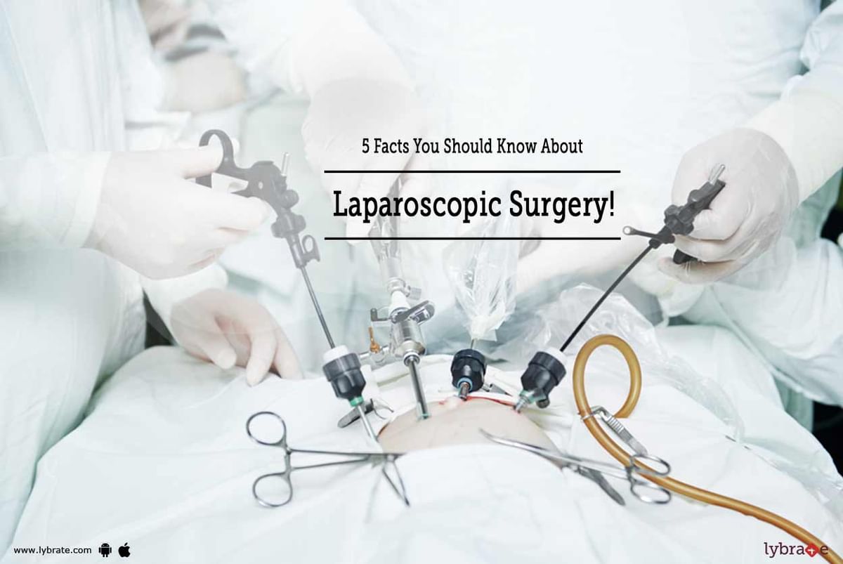 5 Facts You Should Know About Laparoscopic Surgery! - By Dr. Ramya ...