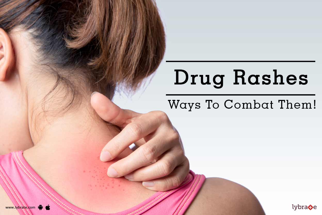 Drug Rashes Ways To Combat Them! By Dr. Archit Aggarwal Lybrate