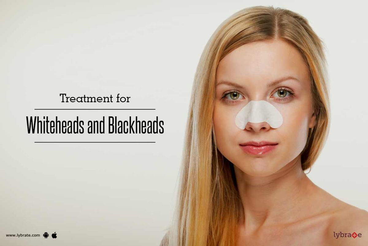 Treatment for Whiteheads and Blackheads By Kaya Skin Clinic Lybrate