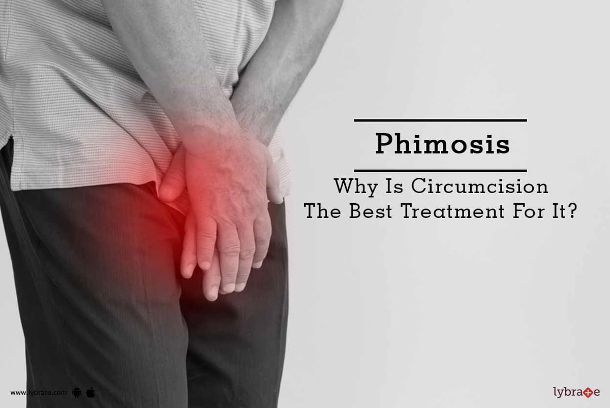 Phimosis - Why Is Circumcision The Best Treatment For It? - By Dr