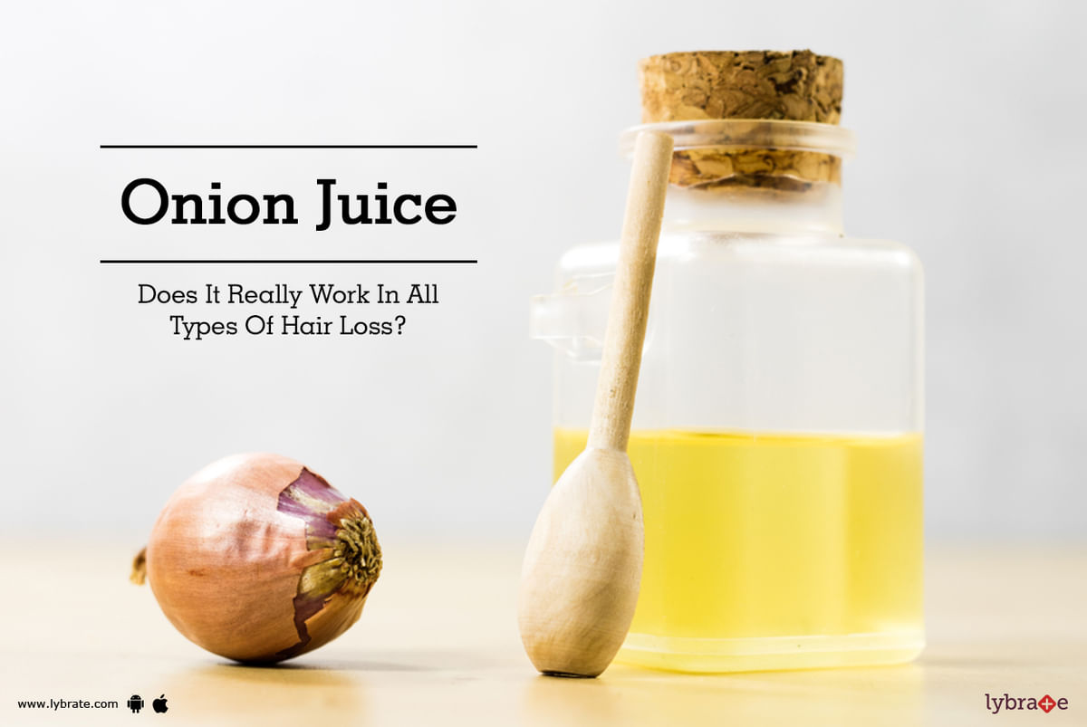 Dr Sasikumar Muthu - Onion Juice.!!!!???. : Does onion juice promote hair  regrowth???. : A research conducted 10 years ago, that too single paper  study showed some positive impact. : How?? The