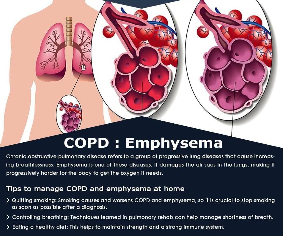 centriacinar-centrilobular-emphysema-medicine-hack