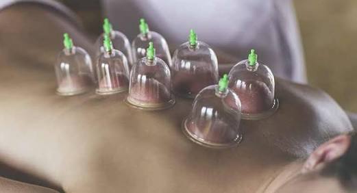 Cupping Therapy And Its Benefits! By Dr. Yogitaa Mandhyaan Lybrate