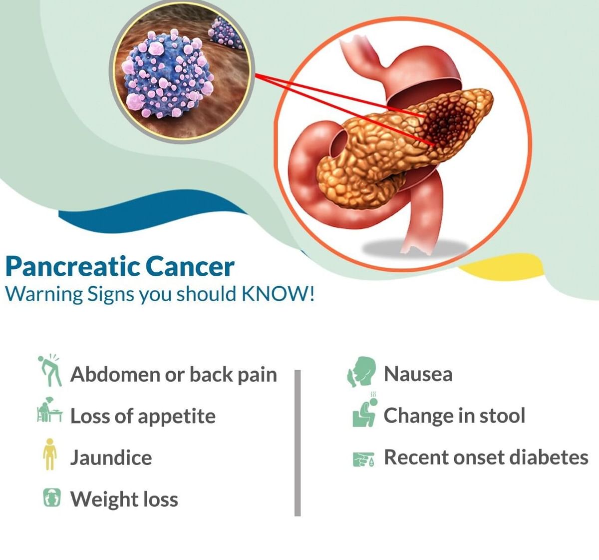 Symptoms Of Pancreatic Cancer! - By Dr. Nikhil Agrawal | Lybrate