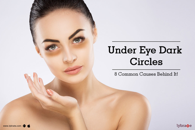 What causes dark circles under eyes? And how to get rid of them.