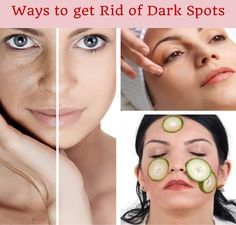 Dark Spots On Your Face Natural Treatment By Dr Nikunj Gupta Lybrate