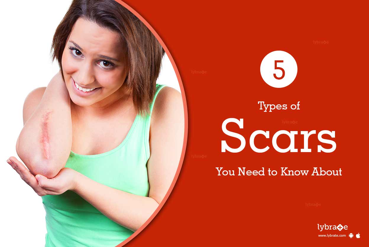 5 Types of Scars You Need to Know About By Dr. Shobha Jindal Lybrate