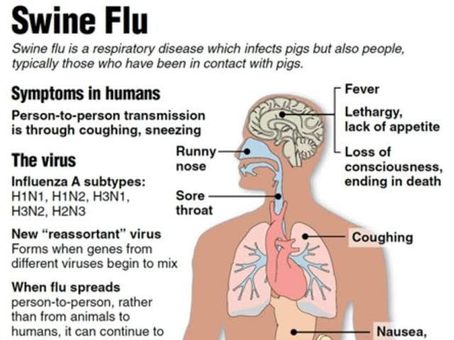 New throated. Swine Flu Symptoms. Swine influenza. Swine Flu Laboratory.