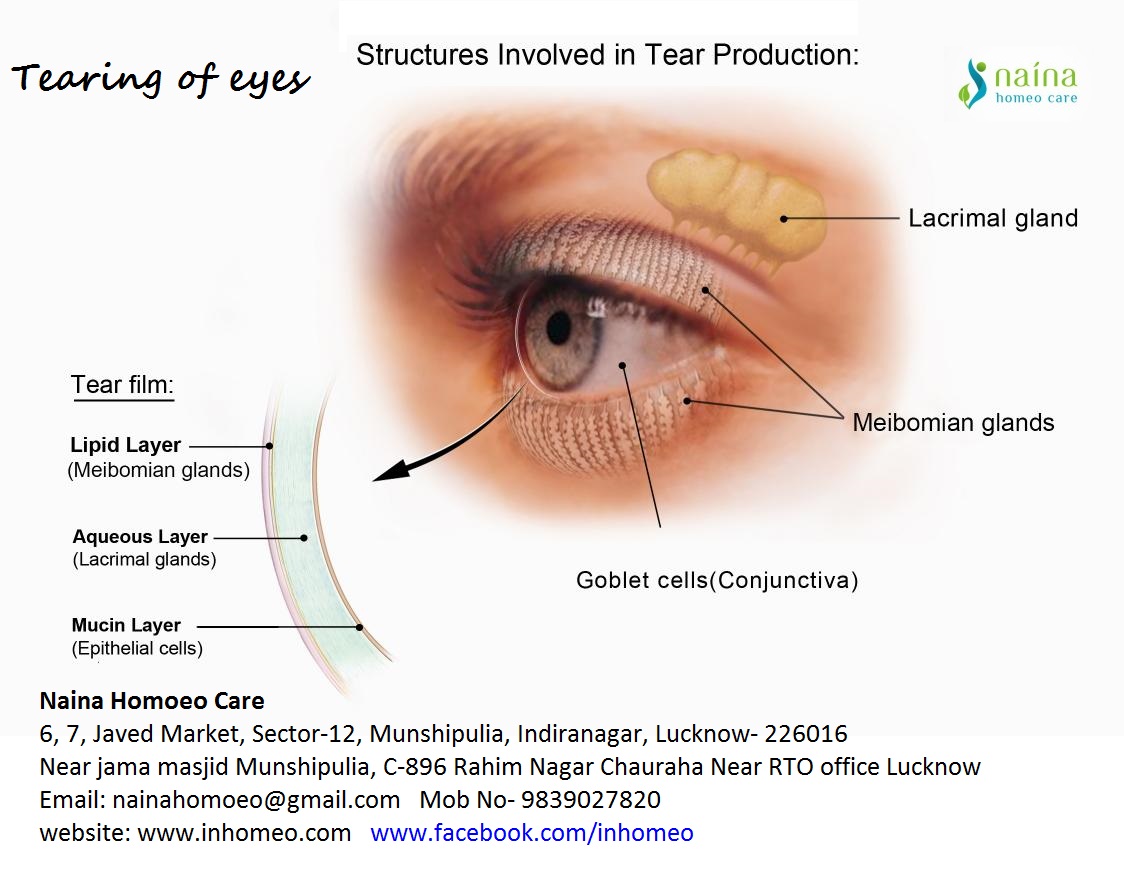 Tearing of Eyes Problem By Dr. Sameer Kumar Singh Lybrate