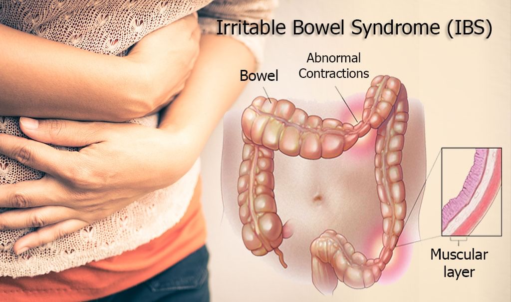 Obstrucción intestinal en ancianos tratamiento