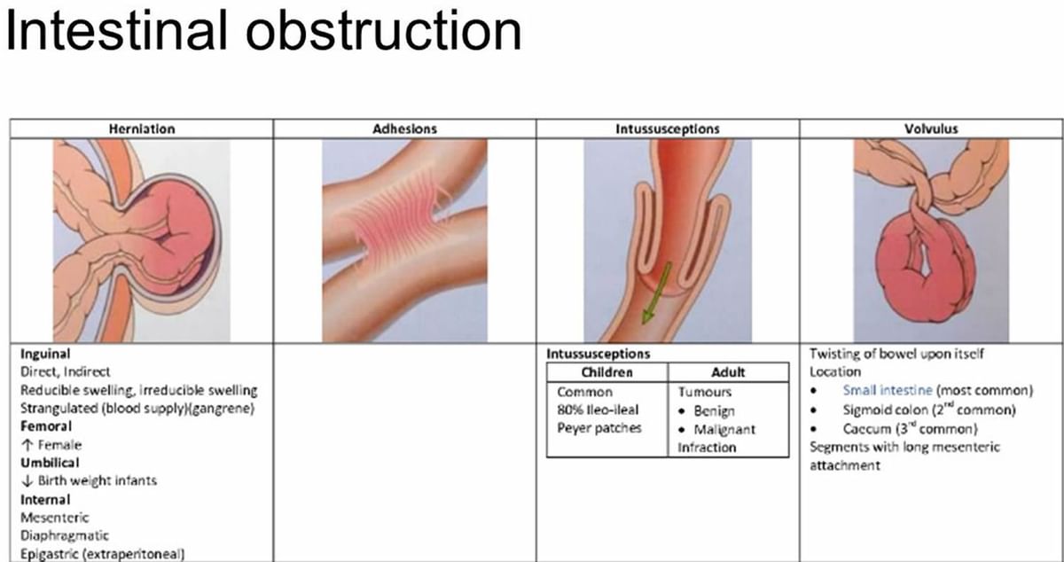 Intestinal Obstruction due to Bilateral Strangulated Femoral Hernias