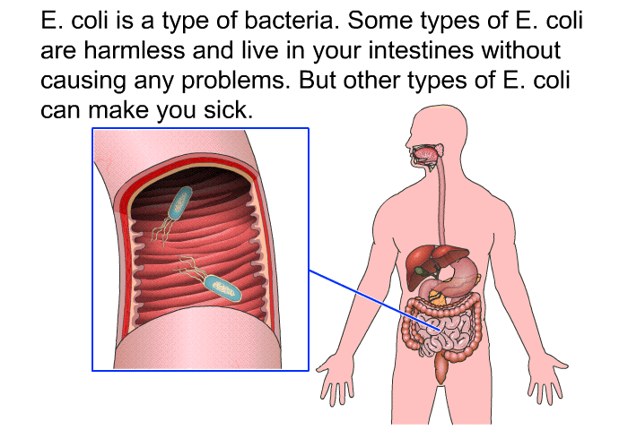 Treatment of E. coli! By Dr. Radhika Amulraj Lybrate