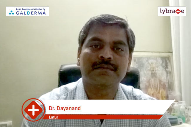 Lybrate | Dr Dayanand speaks on IMPORTANCE OF TREATING ACNE EARLY - By ...